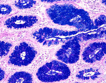 Kit de reactivos colorante - AB-PAS  - Celnovte Biotechnology Co., Ltd. - para histologia