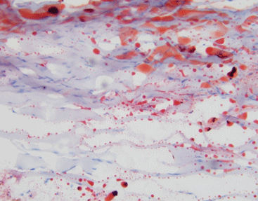 Kit de reactivos colorante - Celnovte Biotechnology Co., Ltd. - para histologia / de lípidos