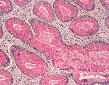 Kit de reactivos colorante - Celnovte Biotechnology Co., Ltd. - para histologia / de Cryptococcus neoformans
