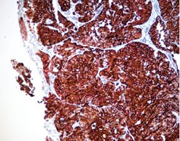 Reactivo colorante - SD8002 - Celnovte Biotechnology Co., Ltd. - para inmunohistoquímica / de fosfatasa alcalina / cromogénico