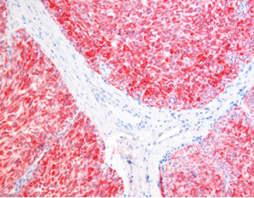 Reactivo solución de coloración - SD8007 - Celnovte Biotechnology Co., Ltd. - de tejidos / para inmunohistoquímica / de fosfatasa alcalina