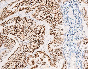 Reactivo anticuerpo monoclonal - CEM-0081 - Celnovte Biotechnology Co., Ltd. - anticuerpo policlonal / para la investigación / de tejidos