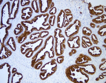 Reactivo anticuerpo monoclonal - CPM-0404 - Celnovte Biotechnology Co., Ltd. - anticuerpo policlonal / enzima / proteasa