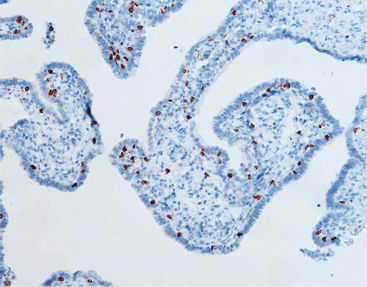 Reactivo anticuerpo monoclonal - CCM-0332 - Celnovte Biotechnology Co., Ltd. - anticuerpo policlonal / para la investigación / de tejidos