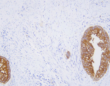 Reactivo anticuerpo monoclonal - CCM-0833 - Celnovte Biotechnology Co., Ltd. - anticuerpo policlonal / para la investigación / de tejidos