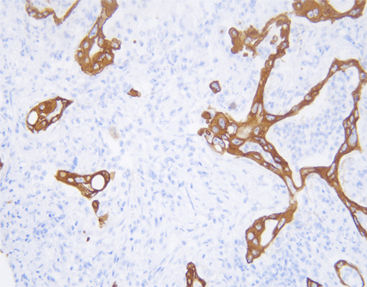 Reactivo anticuerpo monoclonal - CCM-1003 - Celnovte Biotechnology Co., Ltd. - anticuerpo policlonal / para la investigación / de tejidos
