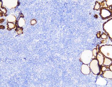 Reactivo anticuerpo monoclonal - CTM-0162 - Celnovte Biotechnology Co., Ltd. - anticuerpo policlonal / enzima / para la investigación