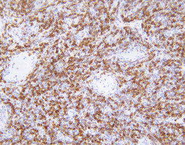 Reactivo anticuerpos - CBM-0042 - Celnovte Biotechnology Co., Ltd. - de citogenética / de apoptosis