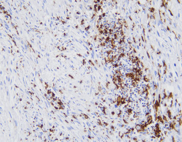 Reactivo anticuerpos - CCM-0702 - Celnovte Biotechnology Co., Ltd. - de tejidos / para inmunohistoquímica / de marcadores tumorales
