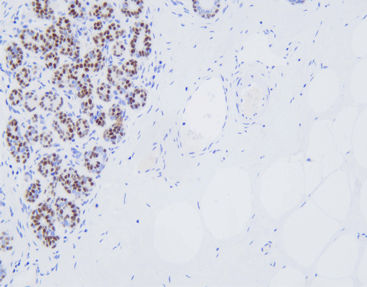 Reactivo anticuerpos - CSM-0181 - Celnovte Biotechnology Co., Ltd. - clínico / para inmunohistoquímica / para el cáncer