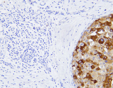 Reactivo anticuerpo monoclonal - CMM-0112 - Celnovte Biotechnology Co., Ltd. - anticuerpo policlonal / para la investigación / de tejidos