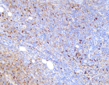Reactivo anticuerpo monoclonal - CKM-0014 - Celnovte Biotechnology Co., Ltd. - anticuerpo policlonal / para la investigación / de tejidos