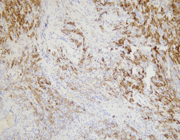 Reactivo anticuerpo monoclonal - CIM-0151 - Celnovte Biotechnology Co., Ltd. - anticuerpo policlonal / para la investigación / de tejidos