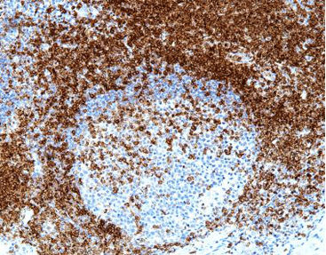 Reactivo solución de coloración - CCM-0354 - Celnovte Biotechnology Co., Ltd. - colorante / antígeno / de tejidos