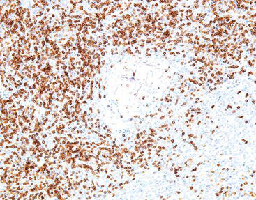 Reactivo solución de coloración - CCM-0372 - Celnovte Biotechnology Co., Ltd. - colorante / antígeno / de tejidos