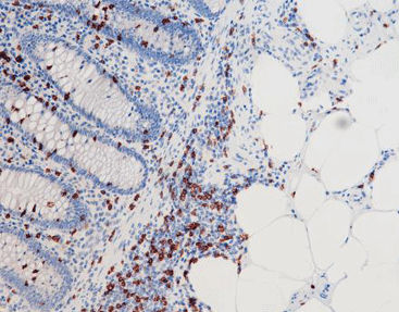 Reactivo solución de coloración - CCM-0374 - Celnovte Biotechnology Co., Ltd. - anticuerpos / colorante / de tejidos