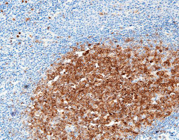 Reactivo solución de coloración - CCM-0391 - Celnovte Biotechnology Co., Ltd. - colorante / antígeno / de tejidos