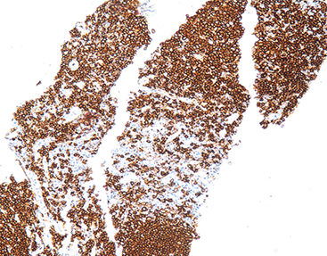 Reactivo solución de coloración - CCM-0461 - Celnovte Biotechnology Co., Ltd. - colorante / antígeno / de tejidos