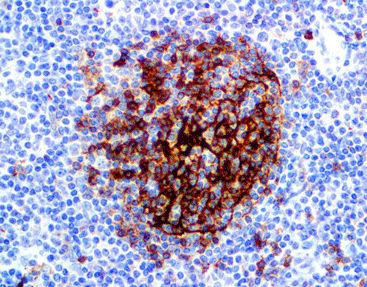 Reactivo solución de coloración - CCM-0483 - Celnovte Biotechnology Co., Ltd. - anticuerpos / colorante / de tejidos