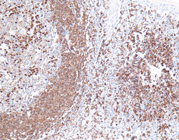 Reactivo solución de coloración - CCM-0734 - Celnovte Biotechnology Co., Ltd. - anticuerpos / de tejidos / para citología