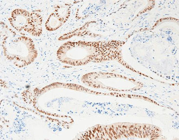 Reactivo solución de coloración - CCR-0822 - Celnovte Biotechnology Co., Ltd. - anticuerpos / colorante / de tejidos
