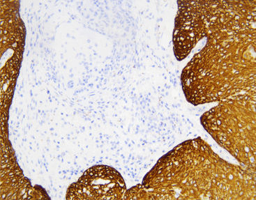 Reactivo solución de coloración - CCM-0983 - Celnovte Biotechnology Co., Ltd. - anticuerpos / colorante / clínico