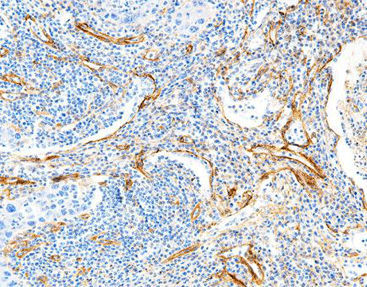 Reactivo anticuerpos - CCM-1132 - Celnovte Biotechnology Co., Ltd. - solución de coloración / colorante / colágeno