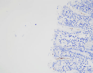 Reactivo solución de coloración - CHM-0173 - Celnovte Biotechnology Co., Ltd. - anticuerpos / colorante / de tejidos