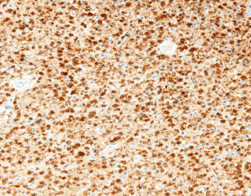 Reactivo solución de coloración - CIM-0200 - Celnovte Biotechnology Co., Ltd. - anticuerpos / colorante / de tejidos