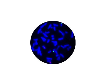 Kit de prueba de fiebre tifoidea - CF1236 - Celnovte Biotechnology Co., Ltd. - para la investigación / para el cáncer / para la investigación médica