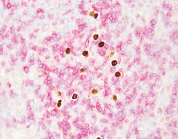 Kit de prueba para enfermermedades infecciosas - Celnovte Biotechnology Co., Ltd. - del virus de Epstein-Barr / por inmunofluorescencia / molecular