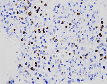 Kit de prueba para el cáncer - Celnovte Biotechnology Co., Ltd. - de células / de tejidos