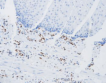 Reactivo solución de coloración - CER-0071 - Celnovte Biotechnology Co., Ltd. - anticuerpos / colorante / de tejidos