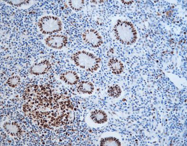 Reactivo solución de coloración - CMM-0202 - Celnovte Biotechnology Co., Ltd. - anticuerpos / colorante / de tejidos