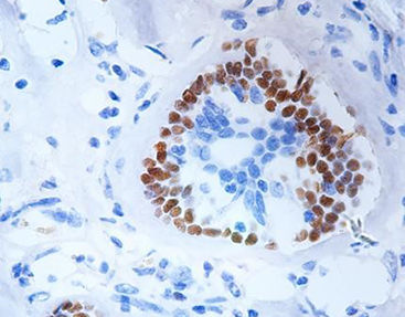 Reactivo solución de coloración - CPM-0160 - Celnovte Biotechnology Co., Ltd. - anticuerpos / colorante / para citología