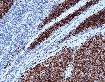 Reactivo ADN polimerasas - CTM-0132 - Celnovte Biotechnology Co., Ltd. - solución de coloración / enzima / colorante