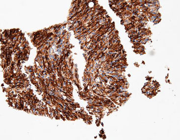 Reactivo solución de coloración - CTM-0213 - Celnovte Biotechnology Co., Ltd. - anticuerpos / colorante / de tejidos