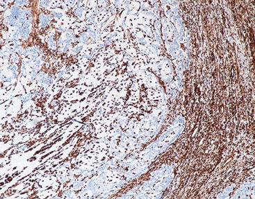 Reactivo solución de coloración - CVM-0040 - Celnovte Biotechnology Co., Ltd. - anticuerpos / colorante / de tejidos