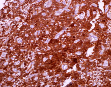 Reactivo solución de coloración - CAM-0160 - Celnovte Biotechnology Co., Ltd. - anticuerpos / colorante / de tejidos
