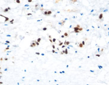 Reactivo solución de coloración - CAM-0211 - Celnovte Biotechnology Co., Ltd. - anticuerpos / colorante / para citología