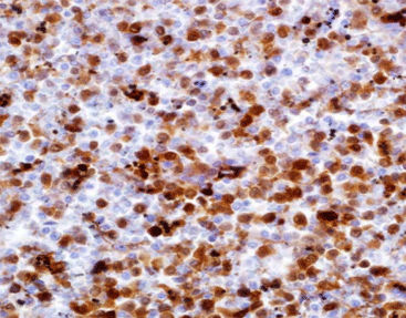 Reactivo solución de coloración - CAM-0220 - Celnovte Biotechnology Co., Ltd. - anticuerpos / colorante / de tejidos