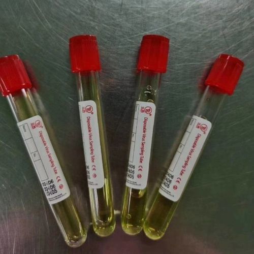 Tubo de extracción desechable - 20200006 - Cangzhou Yongkang Medical Devices Co., Ltd. - para diagnóstico / cilíndrico / nasal