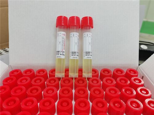 Tubo de extracción de laboratorio - Cangzhou Yongkang Medical Devices Co., Ltd. - cilíndrico / nasal / faríngeo