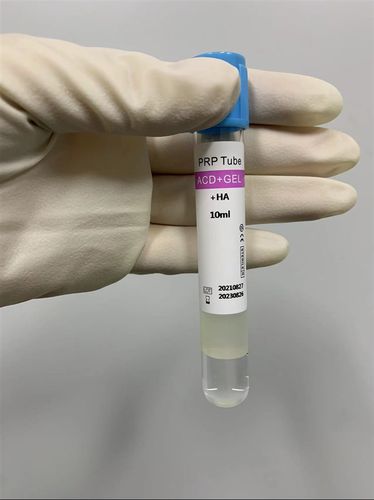Tubo de extracción para plasma rico en plaquetas - Cangzhou Yongkang Medical Devices Co., Ltd. - cilíndrico / de sangre / por plasma