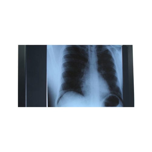 Negatoscopio 1 pantalla - Woodmans Meditech - LED