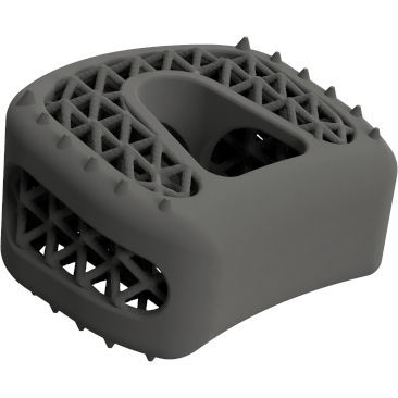 Caja intersomática cervical - BMD ACIF GW ® - Global Biomedica - vía anterior / de titanio
