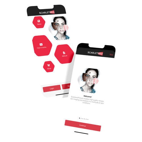 Aplicación Android de control - Scarletred®Vision - SCARLETRED Holding GmbH - de captura / de calibración / dermatología