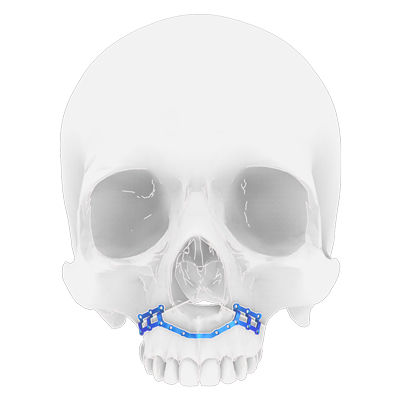Placa de osteotomía para maxilares - Osteophoenix - de titanio