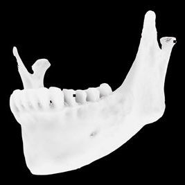 Modelo anatómico óseo - Osteophoenix - mandibular / para cirugía dental