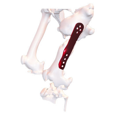 Placa de compresión ósea veterinaria genérica - Osteophoenix